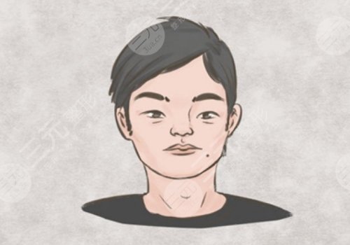 山根有横纹是怎么回事?