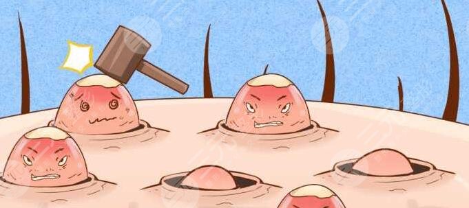 硫磺香皂洗脸注意什么?