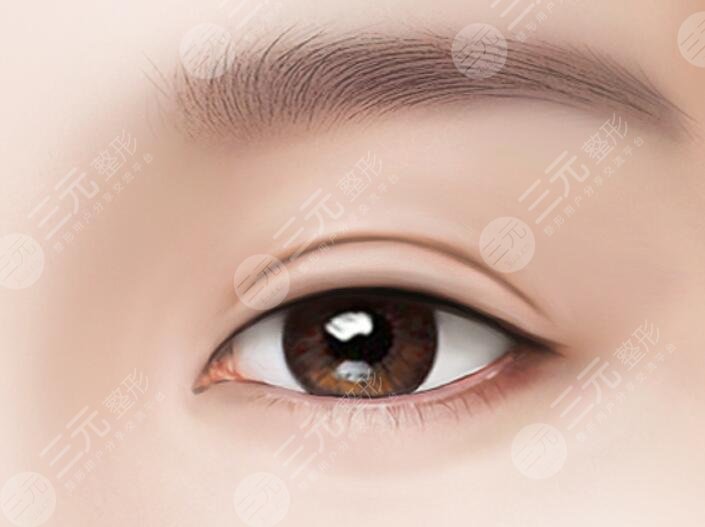 韩式眼部整形价格多少钱2023？韩式眼部整形的优势与注意事项了解~