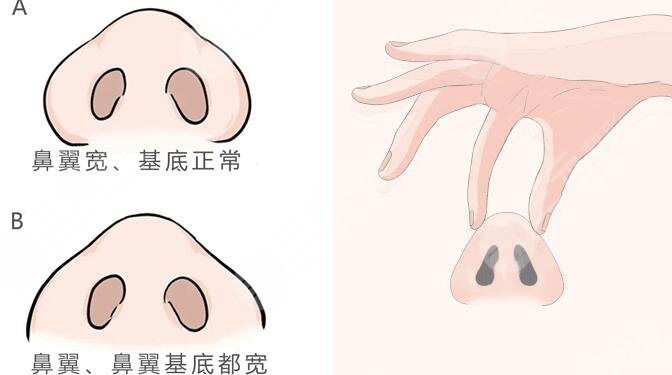 广州李琳医生擅长项目