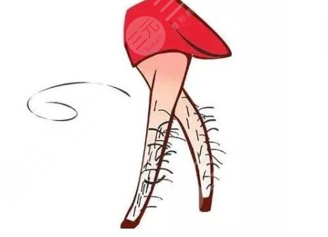 激光脱毛的优势有哪些?