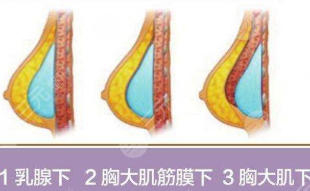 北京八大处医院王连召医生怎么样？