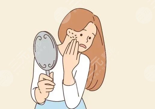 激光缓解痤疮有副作用吗?