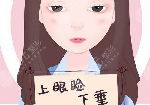 上睑下垂矫正大概需要多少费用?