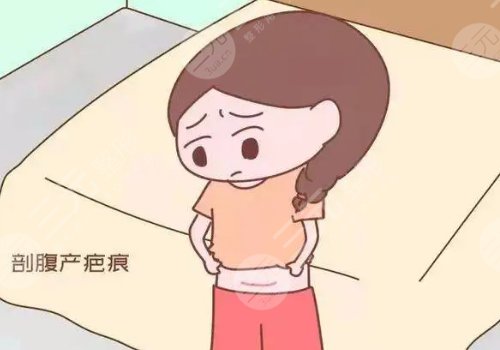 激光去疤痕需要几次才能彻底消除？