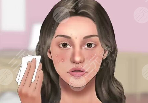 去黑头收缩毛孔好的方法有哪些？