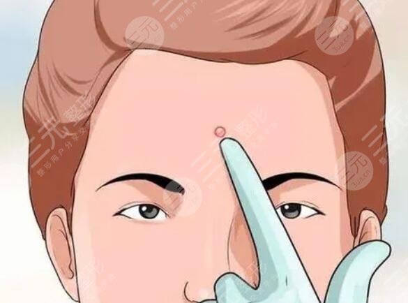 青春痘缓解价格多少钱一般？医院规格、医生实力、痘痘严重程度都在影响价格！