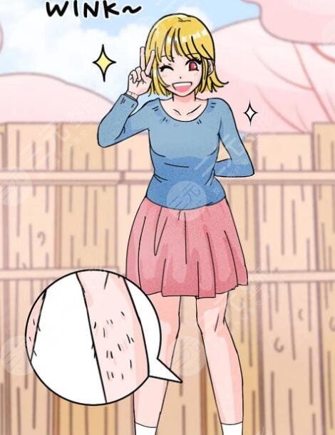 冰点脱毛后注意事项有哪些?