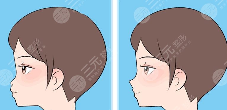 按摩使鼻子变挺