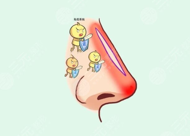 自体脂肪隆鼻