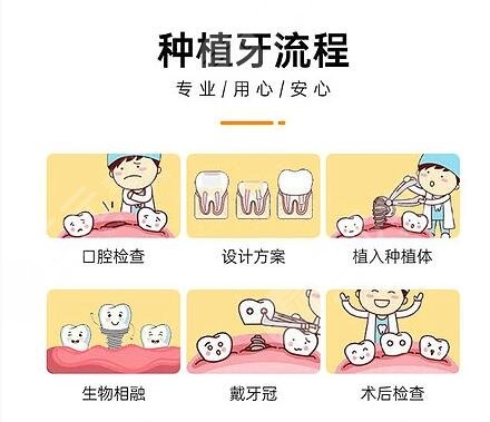 301解放军总医院口腔外科牙齿种植案例