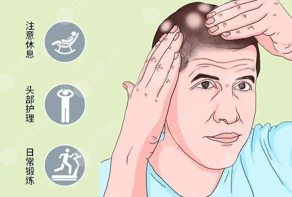 斑秃是怎么引起的?