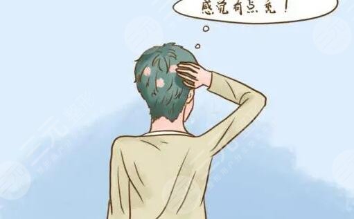 斑秃是怎么引起的?