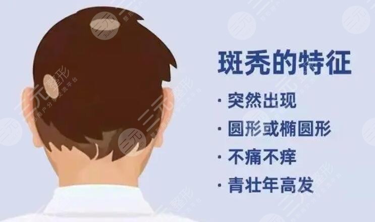 斑秃可以自愈吗?