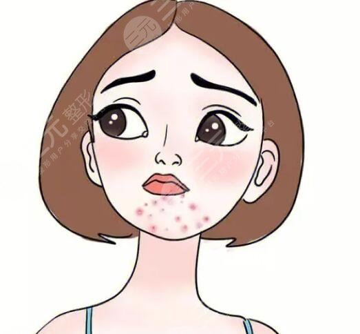 　　很多人经常在下巴处会长一些痘痘，有的人认为长痘痘的原因是和自己的内分泌有关系，也有的女性朋友认为自己的长痘问题和自己的护肤存在一定的关系，所以说在面对自己的痘痘时，一定要充分地了解自己长痘的类型，这样才能够改良痘痘使痘痘消除，所以说想豆豆和我们的身体健康存在一定关系的，大家不但要调整自己的作息习惯，同时也要有正确的护肤流程，一起来了解下吧，长痘的是哪里的问题?  　　下巴长痘痘是哪里的问题?  　　1、饮食问题  　　下巴长痘痘根据饮食有着一定的关系，所以说如果我们长期饮食不规律，在体内的毒素长期积累，从而会影响我们的皮肤状态产生一些皮肤问题，例如长痘痘长色斑等，建议大家在饮食方面坚持以清淡健康的饮食为主，也要少吃一些辛辣刺激性的食物，这样才可以很好地改良肌肤，也要养成良好的作息习惯，可以早睡早起经常参加一些锻炼，也能够减少痘痘的产生，同时也要戒烟戒酒，把这些坏习惯都改掉之后，配合饮食配合作息，就可以改良痘痘。  　　2、激素失衡问题  　　有一些人群下巴长痘痘的原因和自己体内激素分泌有一定的关系，所以说如果激素失衡，也会在下巴处长一些痘痘，比如说女性朋友在来月经之前，身体内的激素会处于一个不平衡的状态，会间接引起皮脂腺分泌旺盛，从而在下巴处长出一些痘痘，如果是这种情况，建议大家一定要放松心情，从而改良睡眠质量，减轻压力，才可以很好地度过这个时期，但是这种痘痘往往在月经过后就会恢复到一个正常的皮肤状态，不用过分的担心。  　　3、内分泌失调  　　内分泌失调也会导致痘痘的产生，所以说在失调的过程当中会使皮脂腺分泌得过于旺盛，由于油脂分泌的较多，不能够及时清洁，很容易堵塞毛孔，产生一些油腻的痘痘，这时候一定要调节自己的内分泌，改良自己的睡眠，才可以改良痘痘，也可以服用一些中药来进行改良。  　　4、体内毒素堆积过多  　　如果我们经常吃一些比较油腻的食物，会引起消化方面的问题，所以说在体内会堆积过多的毒素，从而使毒素没有办法排出，导致痘痘的产生，如果是体内毒素堆积过多，首先长痘的部位就是下巴处，这时候人们的肝脏排毒功能也逐渐下降，一定要积极地调整饮食，健康的作息才可以得到根本的改变，这时候可以吃一些比较常见的排毒养颜胶囊，也可以在专业的医生指导下吃一些中药。  　　5、青春痘  　　很多人在青春期的时候会长一些痘痘，这么也是大家所说的，青春痘在长痘的过程当中还会伴随局部疼痛红肿等问题，一定要积极地寻找医生的缓解，可以选用激光缓解痘痘。