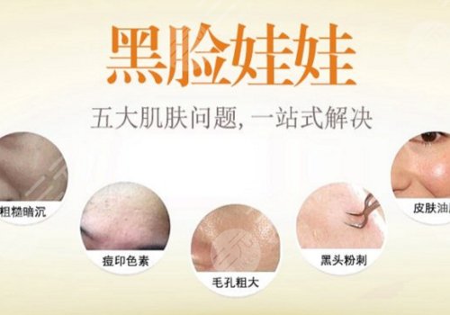 黑脸娃娃有什么功效?