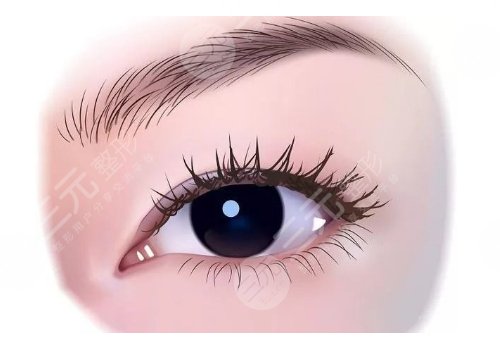 眼部整形有哪些项目？