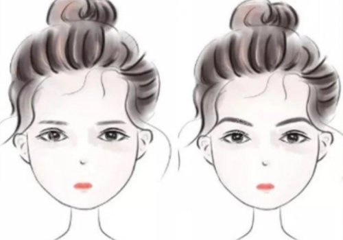 填充太阳凹陷脂肪能保持多久?