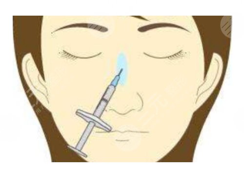 打玻尿酸隆鼻子有副作用吗？