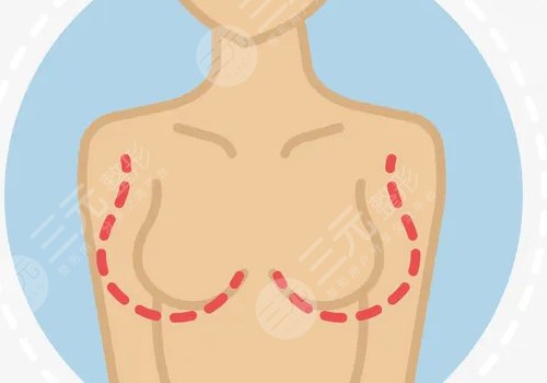 隆胸有什么危害和后遗症吗？