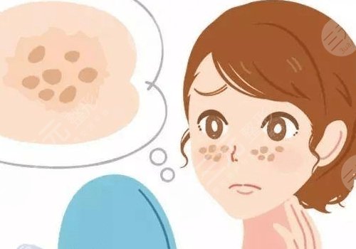 激光祛斑会不会反弹？需要做几次？