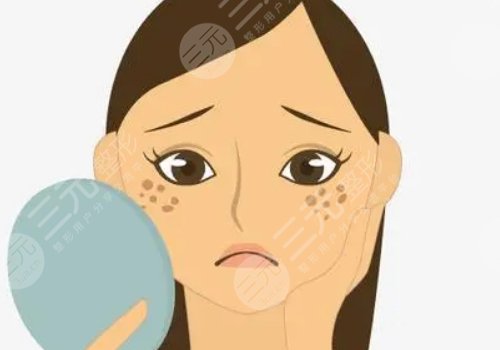 激光祛斑会不会反弹？需要做几次？