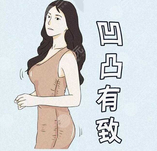 假体隆胸