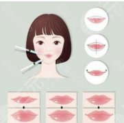 玻尿酸丰唇的效果怎么样？优点及注意事项讲解，柔润美唇指南！