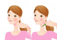 玻尿酸丰下巴一般需要几支？多久恢复自然？注意事项、优势盘点！
