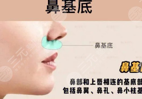 珊瑚骨填充有什么弊端?