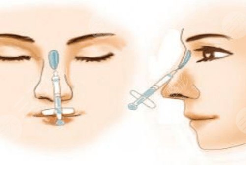 注射复合骨胶原的作用、副作用