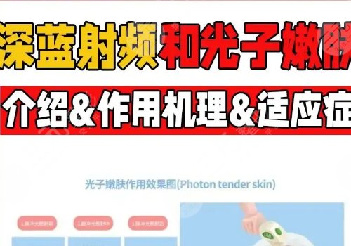 深蓝射频和光子嫩肤哪个好？
