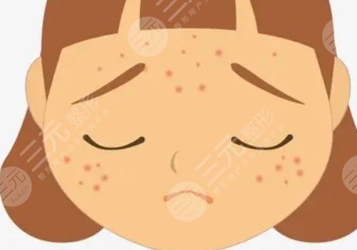 深蓝射频和光子嫩肤哪个好？