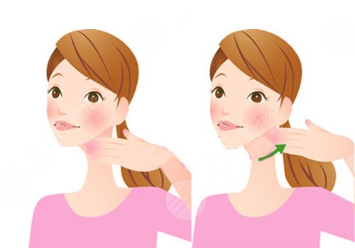 艾莉薇传奇玻尿酸维持多久？