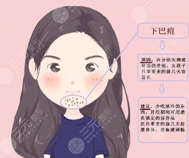 激光祛痘需要多长时间能彻底恢复好？需要缓解几次？疗程是多久？