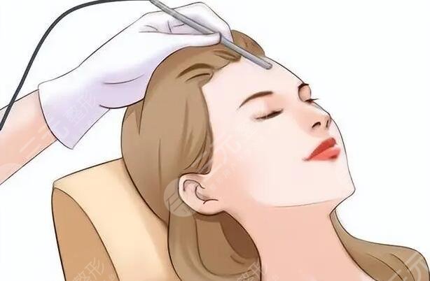 激光嫩肤一般多少钱一次？激光嫩肤注意事项有哪些？适合哪些人？