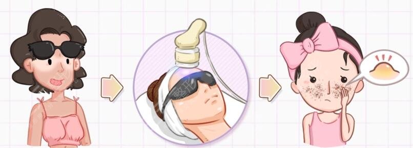 激光嫩肤适用人群