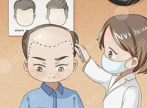 脱发护理注意事项