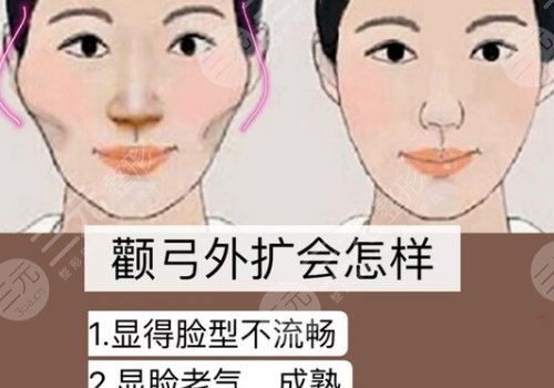 杭州时光陈小平颧骨下颚骨技术怎么样？