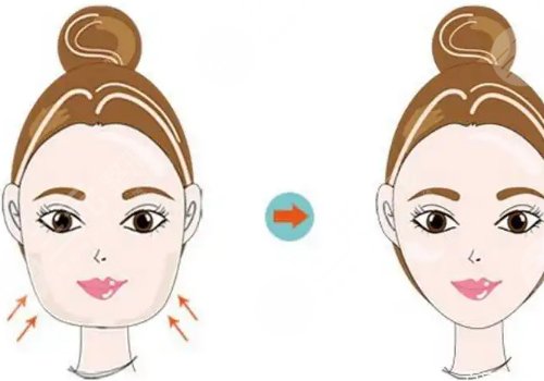 杭州时光陈小平颧骨下颚骨技术怎么样？