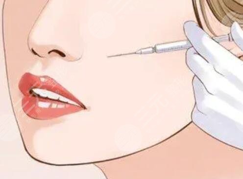 除皱针注射前需要注意什么?