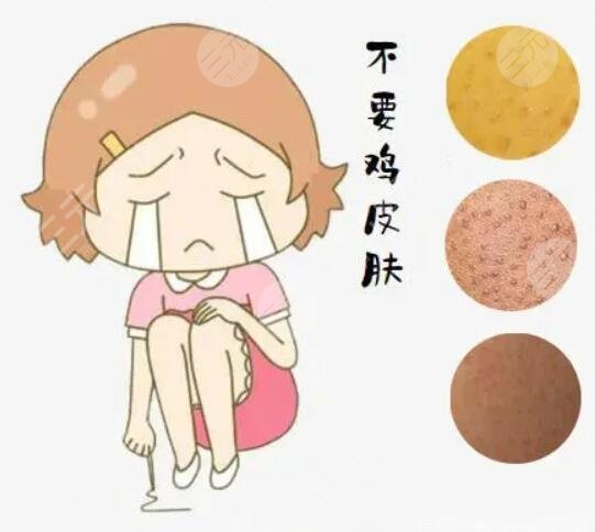 鸡皮局部去角质