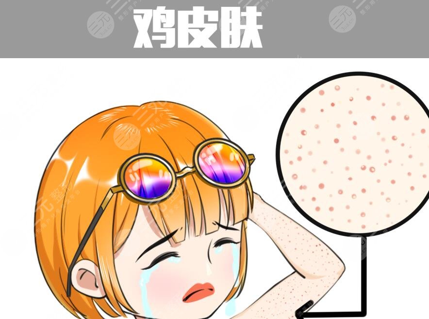 鸡皮疙瘩皮肤怎么治见效快？预防和根治双重入手，避免反复发作！