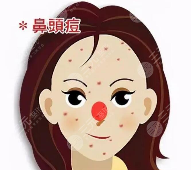 寻求医美缓解：适用于严重痤疮病例