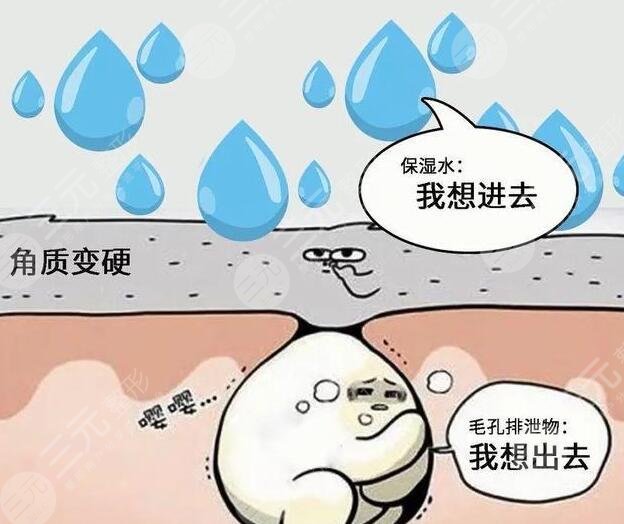 医美去角质的方法——如何选择适合自己的医美方式