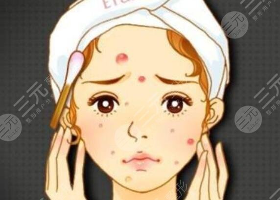 淡化红色痘印的护肤品