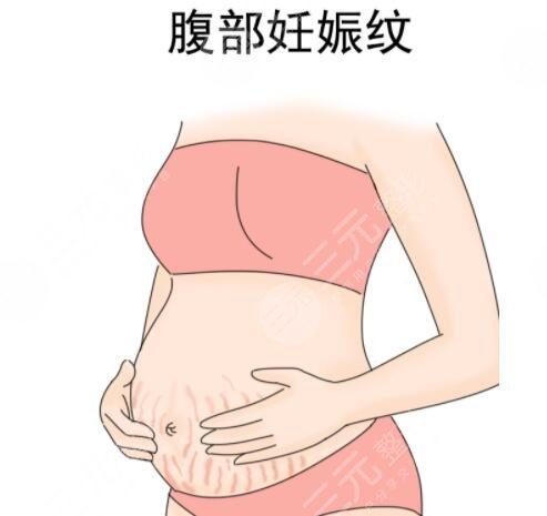 橄榄油其他作用