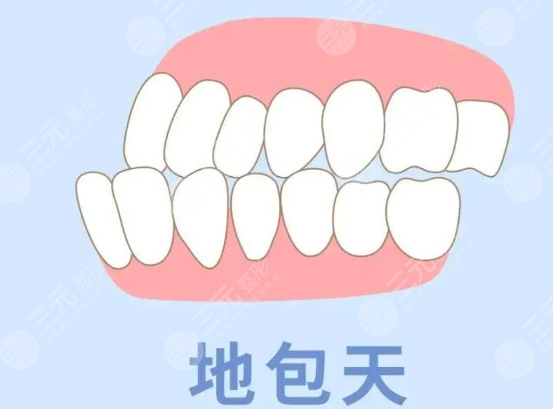 牙齿地包天图片对比,突出(第6页)_大山谷图库