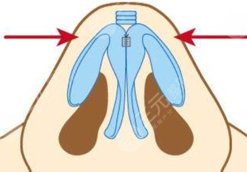 李信锋医生擅长项目