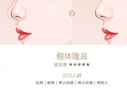 重庆军科医院林勇做鼻子好吗?